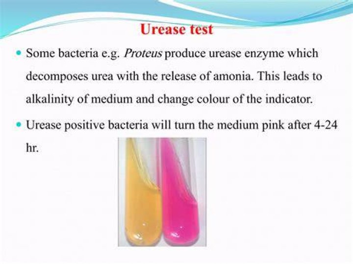 Will bacteria produce urease?