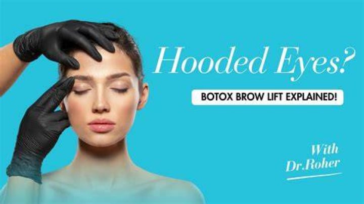 Will botox help my hooded eyes?