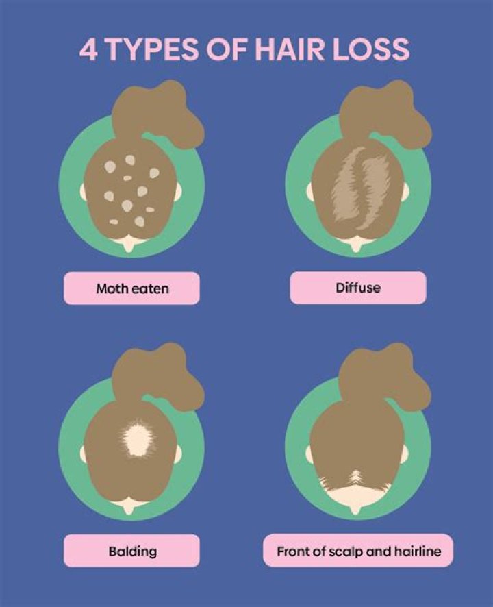 Will coal tar cause hair loss?