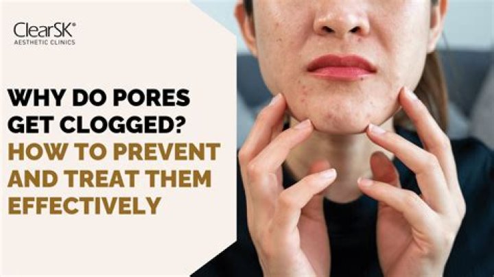 Will dermasil clog pores?