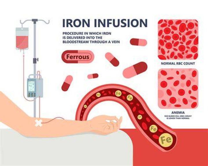 Will iron infusion raise ferritin?