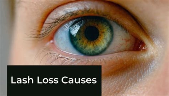 Will my eyelashes grow back?