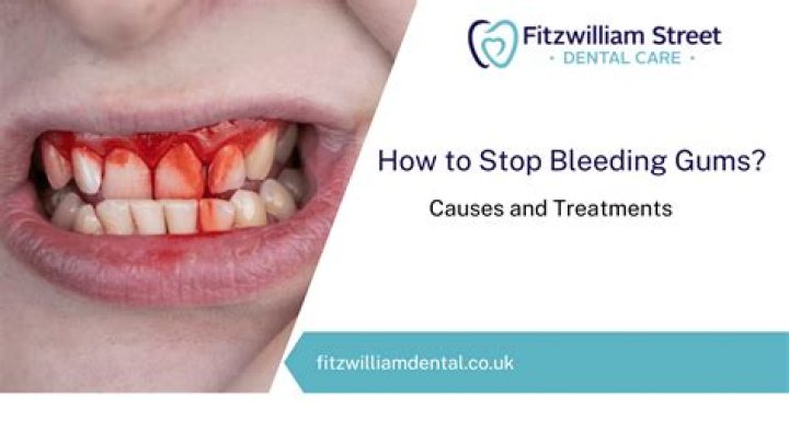 Will my gums stop bleeding when i floss?