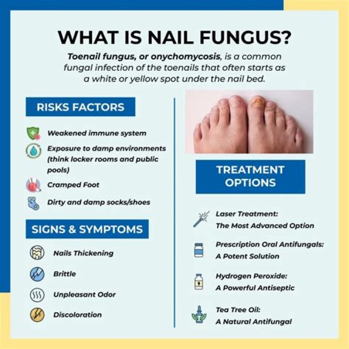 Will naftin cure toenail fungus?