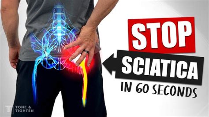 Will osteopath help my sciatica?