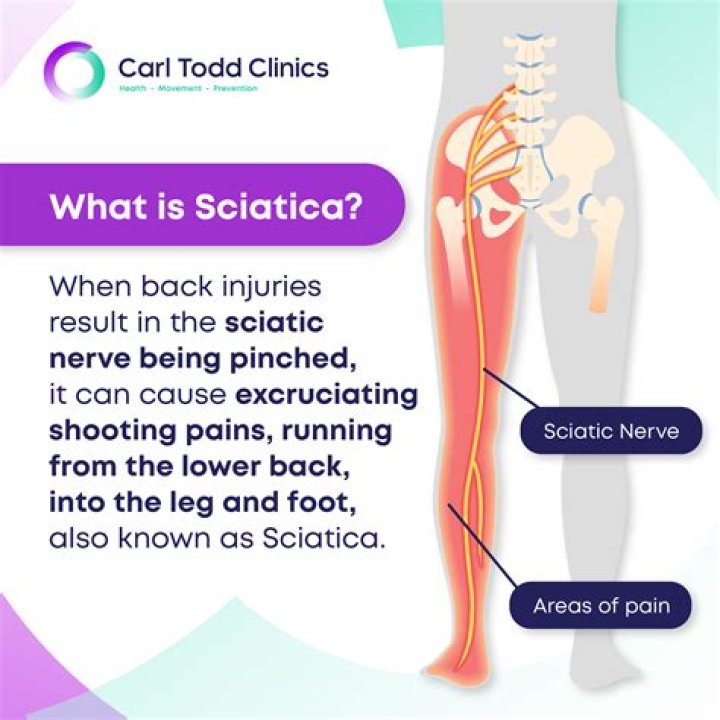 Will sciatic nerve cause hip pain?