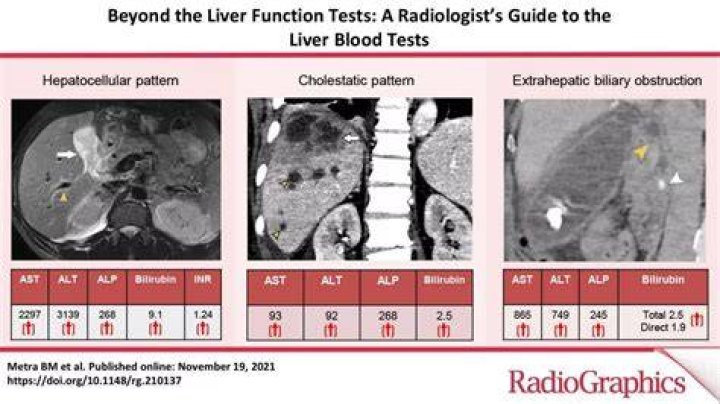 Would blood test show liver problems?