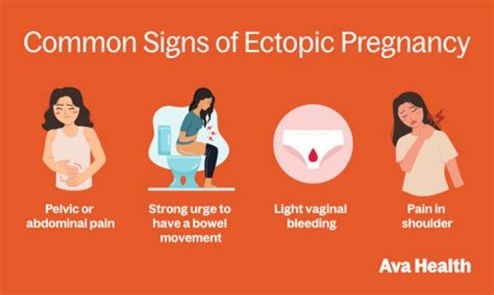 Would ectopic pain come and go?