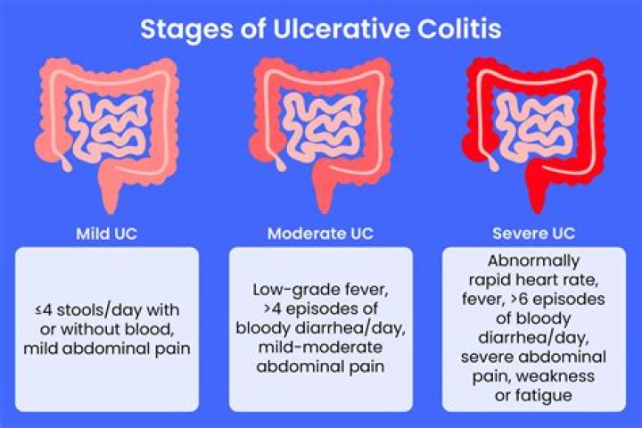 Would ulcerative colitis show on blood test?